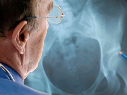 Рентген таза у мужчин и женщин: подготовка, что показывает, особенности Подготовка к рентгену костей таза